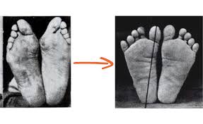 pointy shoes vs no shoes